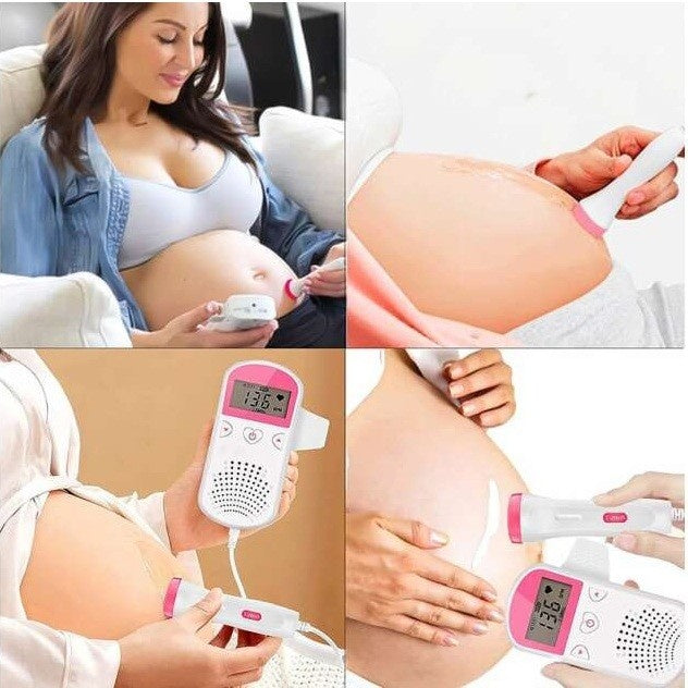 Monitor Fetal Doppler, Monitorizare Sarcina, Ritm Cardiac, Ecran LCD 4.5 cm, 2 x Baterii AA (neincluse), Portabil, din ABS, 12.8 x 9.6 x 3