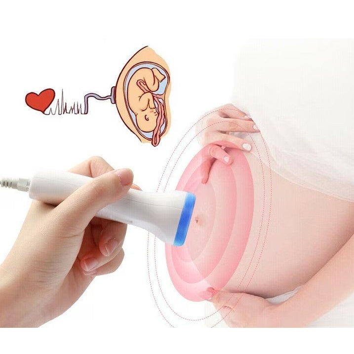 Monitor Fetal Doppler, Monitorizare Sarcina, Ritm Cardiac, Ecran LCD 4.5 cm, 2 x Baterii AA (neincluse), Portabil, din ABS, 12.8 x 9.6 x 3 cm, Utilizare de la 9 Saptamani, Albastru
